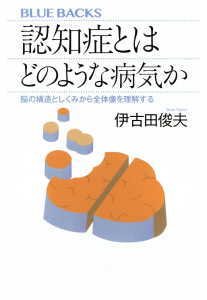 認知症とはどのような病気か(伊古田俊夫)